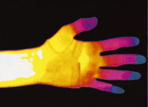 Bandagen - Bandagen in verschiedenen Ausführungen, in Größe 001 bis 002, in Farbe CREME, in Ausführung Rückenbandage Ansicht 4