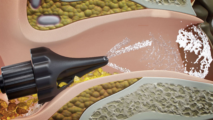 - Elektrische Ohrendusche, in Farbe SCHWARZ Ansicht 3