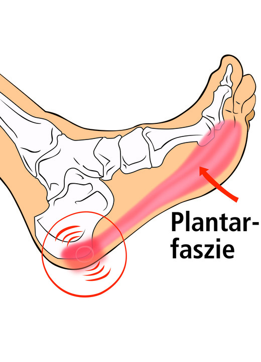 Massage - Vital Comfort Faszien-Fußroller Ansicht 5 Massage - Vital Comfort Faszien-Fußroller, in Farbe ROT Ansicht 5