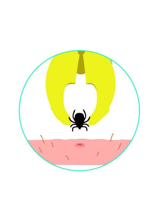 Gesundheit & Pflege - Zeckengreifer Ansicht 3 Gesundheit & Pflege - Zeckengreifer, in Farbe WEISS Ansicht 3