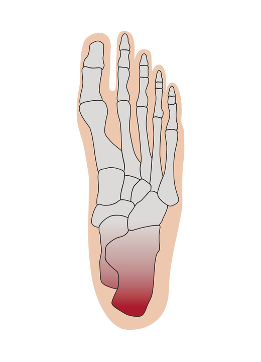 Schuhe & Einlagen - Fersenentlastungspolster, in Größe 001 bis 006, in Farbe LACHS-WEISS Ansicht 2