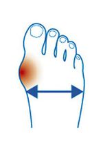 "epitact" Korrekturorthese Hallux-Valgus HAUTFARBEN