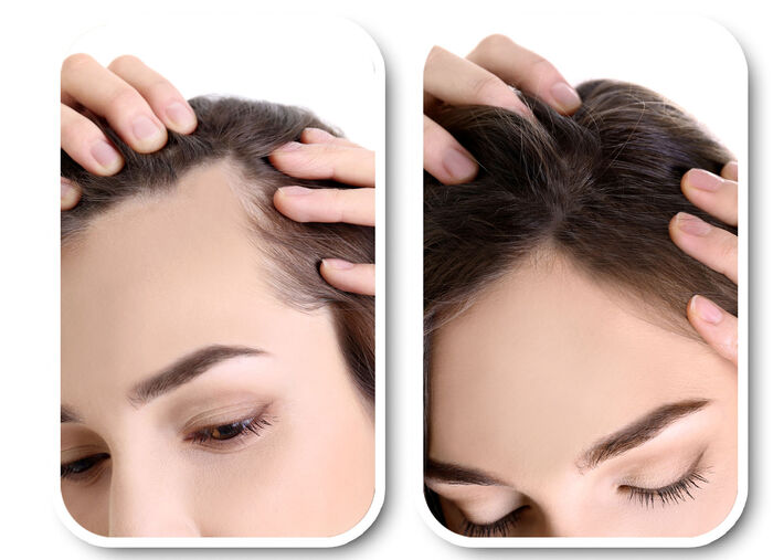 Velform&reg; Nutritional Lotion f&uuml;r jeden Haartyp 