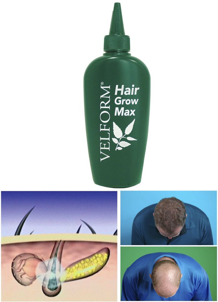 "VELFORM Hair Grow Max" Haarwasser 