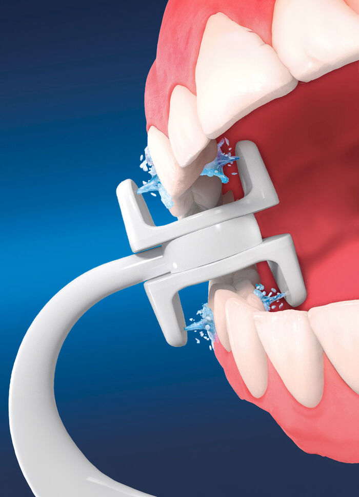 Zusatzaufsätze für Munddusche Corp Care Miracle Smile WEISS