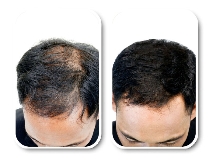 Velform&reg; Nutritional Lotion f&uuml;r jeden Haartyp 