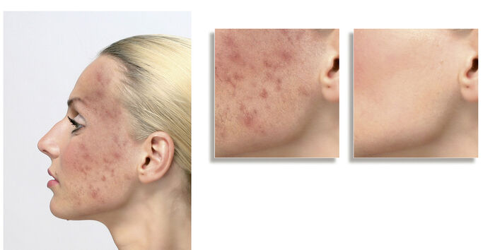 ELITE Cover Make-up DUNKEL